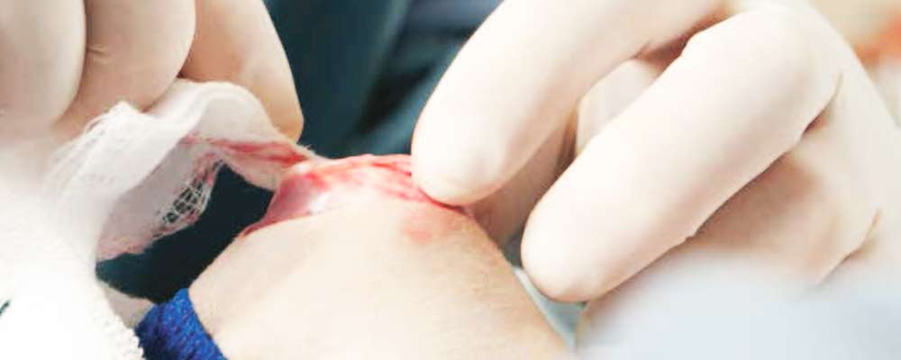 ortopedia-veterinaria-clinivet-clinica-veterinaria-24-horas-camboriu-sc